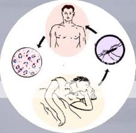 Bệnh sốt rét là gì, Triệu chứng - Điều trị - Phòng chống bệnh sốt rét